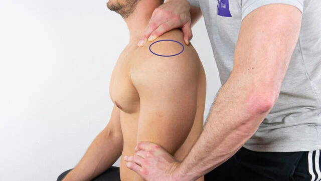shoulder instability 